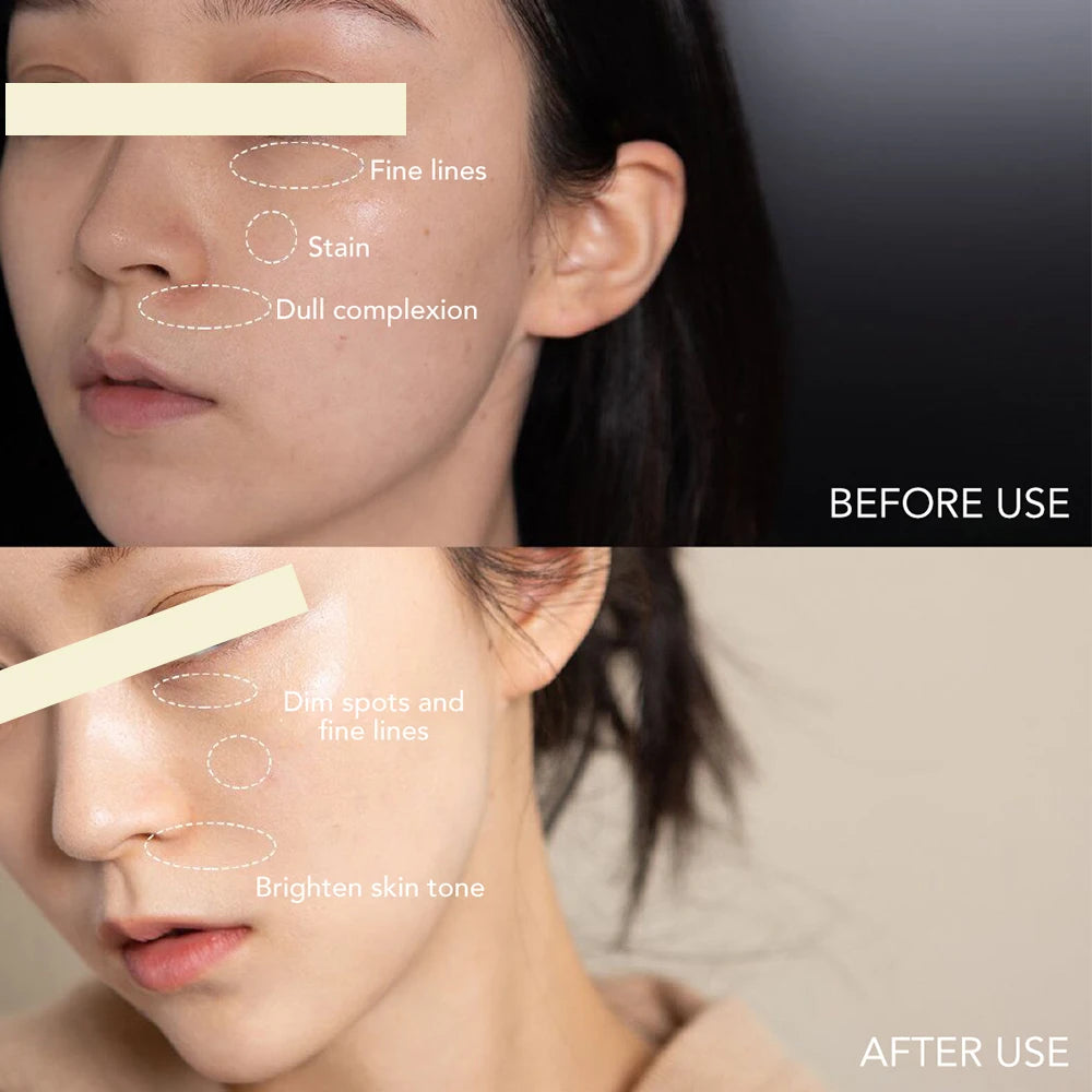 AILKE Dark Spot Corrector Bleaching Hydration Facial Cream SPF35