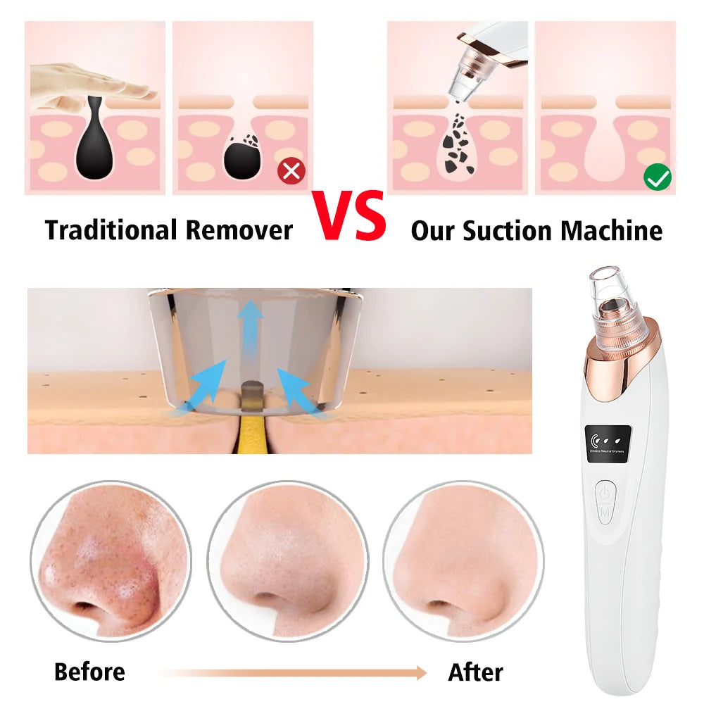 Electric Vacuum Blackhead Remover EMS Ultrasonic Skin Scrubber Spatula Pimple Acne Needle Tool Facial Pore Cleaner Skin Care Set