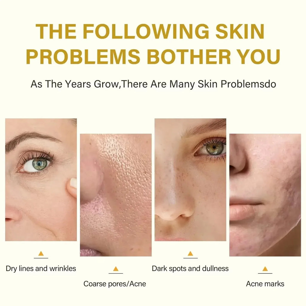 High Quality Chemical Peel Acid Treatment
