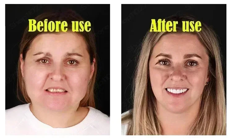 New V-Shape Face Cream