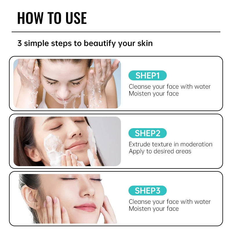 Salicylic Acid Acne Removal Cream