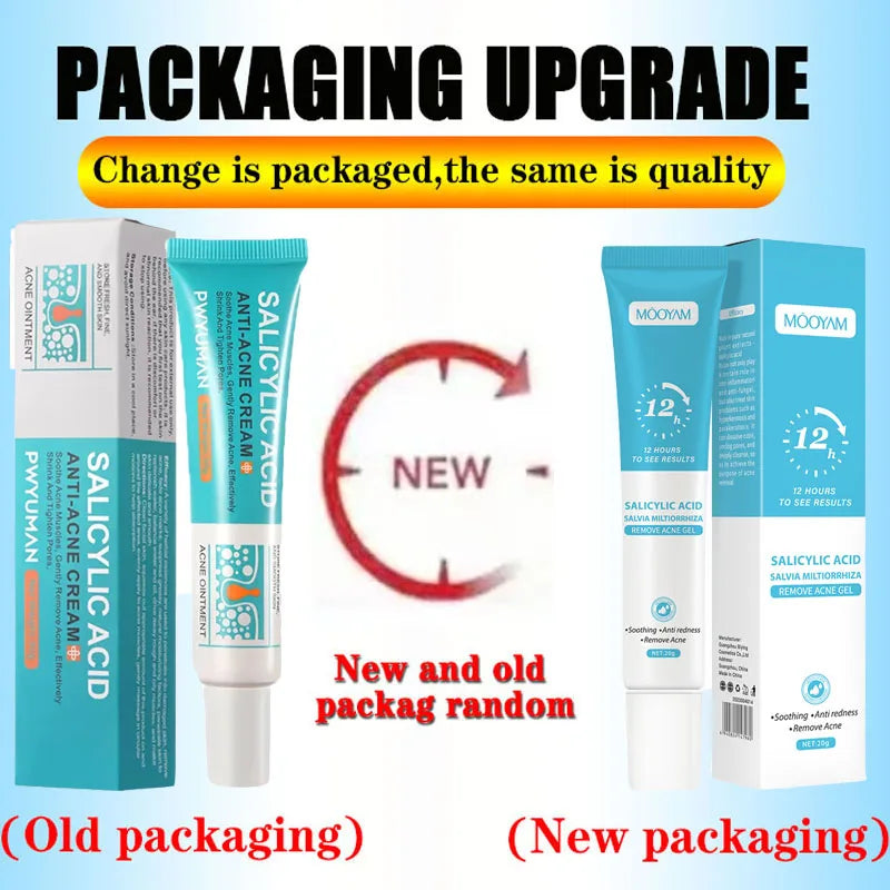 Salicylic Acid Acne Removal Cream