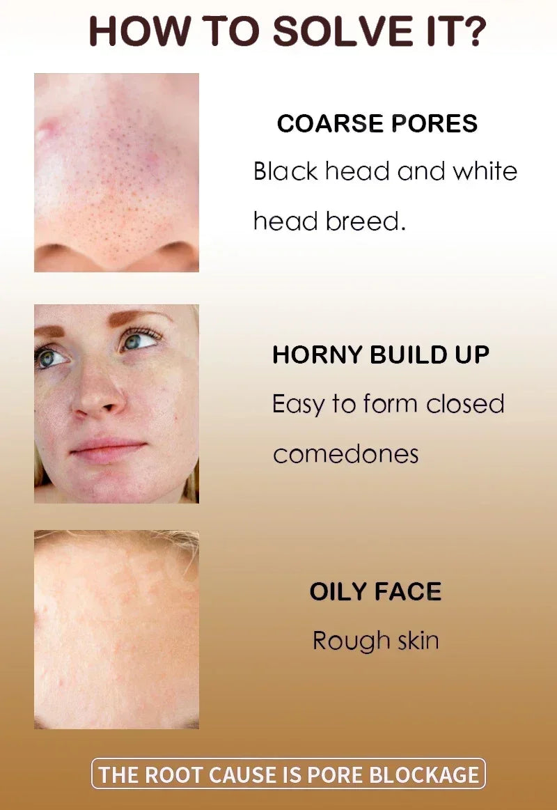 Pore Shrink Face Serum