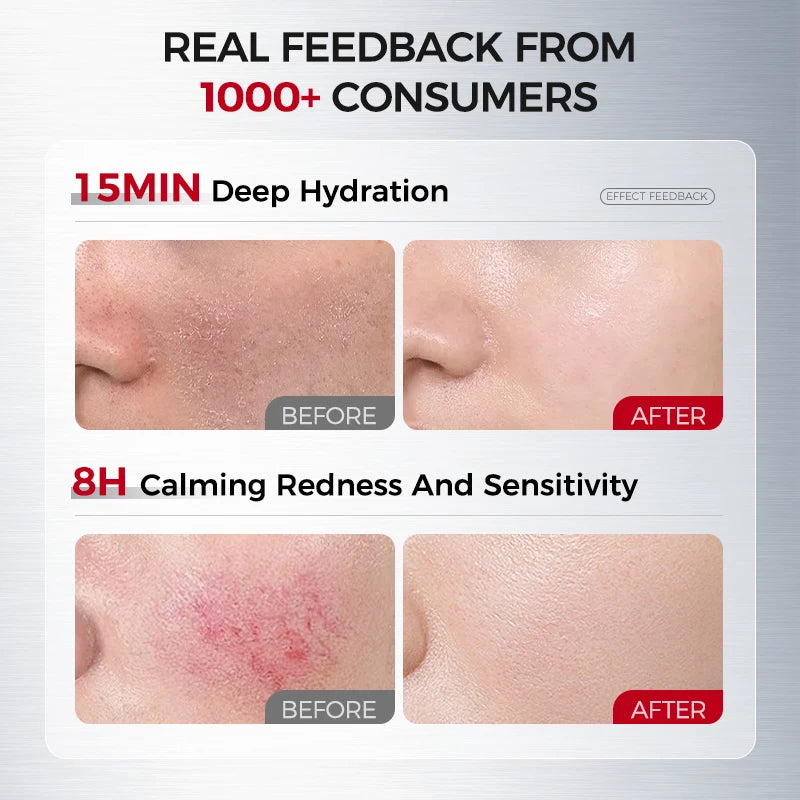 Hydrating & Soothing Toner Lotion & Cream 8D Hyaluronic Acid Ceramides