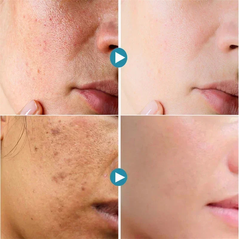 Pore Shrink Face Serum