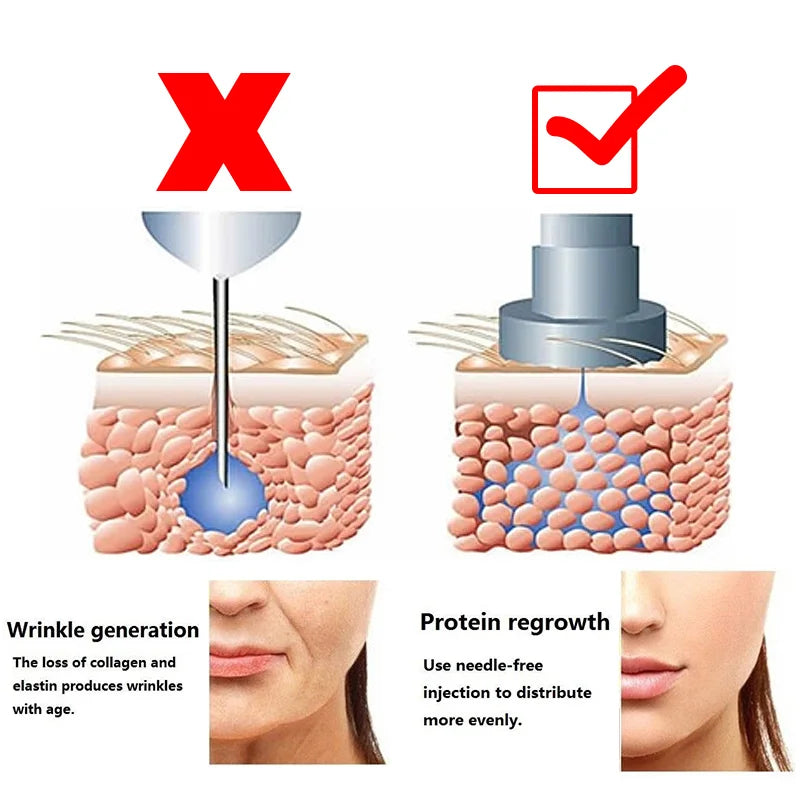 Hyaluron Pen 2in1 Meso Injection Hyaluronic Acid Atomize