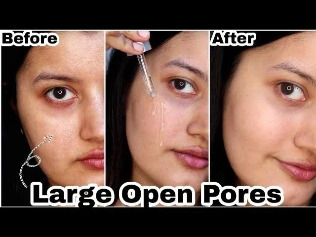 Pore Shrink Face Serum
