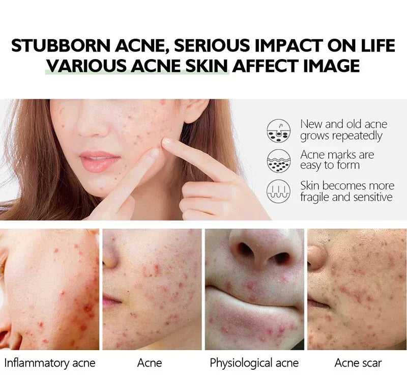 Pore Shrink Face Serum