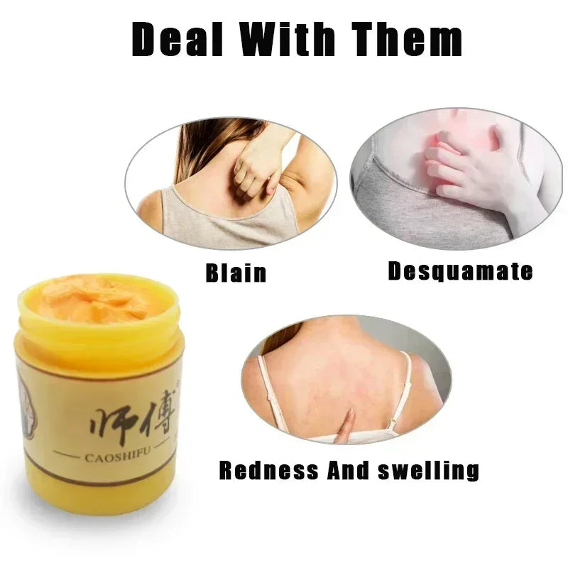Skin Psoriasis Dermatitis Eczema Care Cream