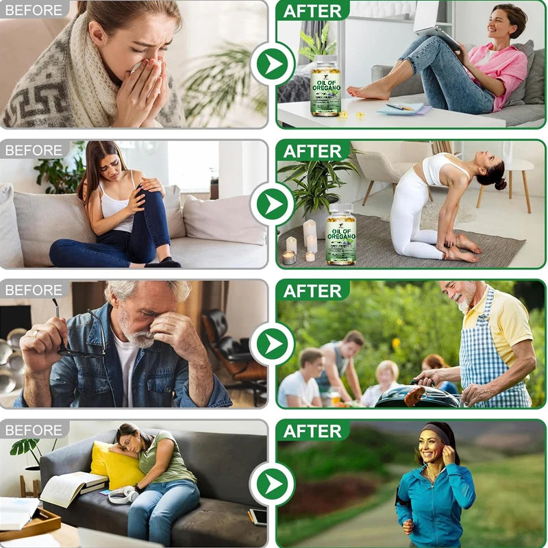 Oil of Oregano Supplement