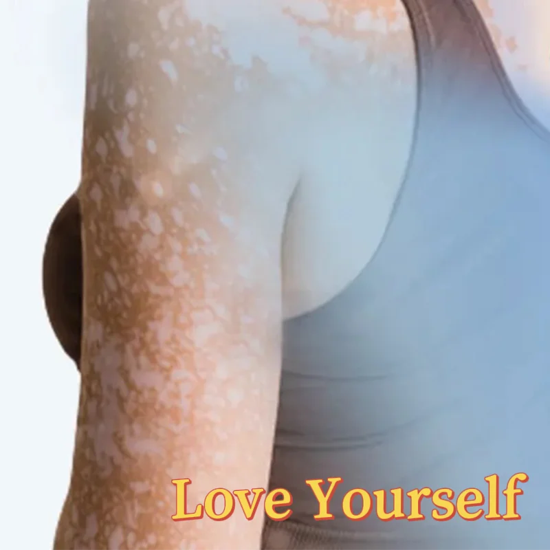 Skin Psoriasis Dermatitis Eczema Care Cream