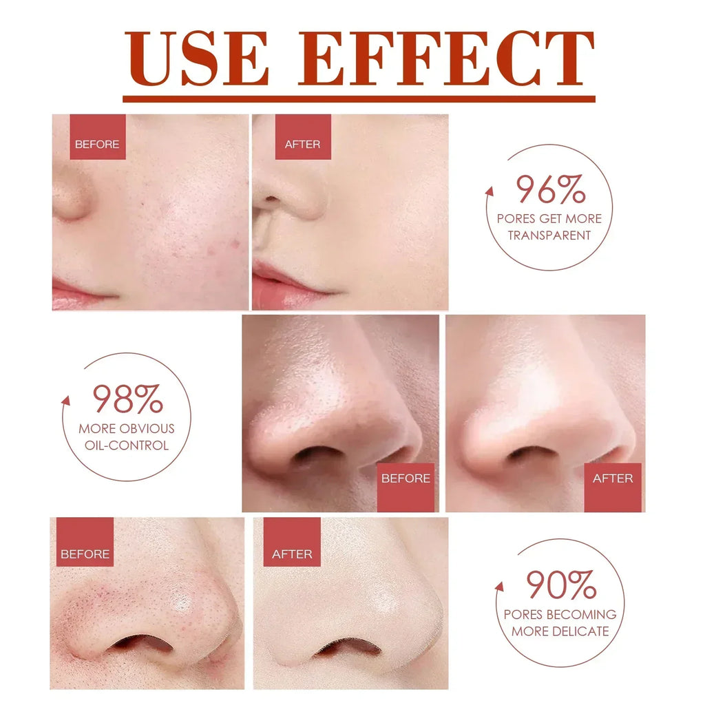 Pore Shrink Face Serum