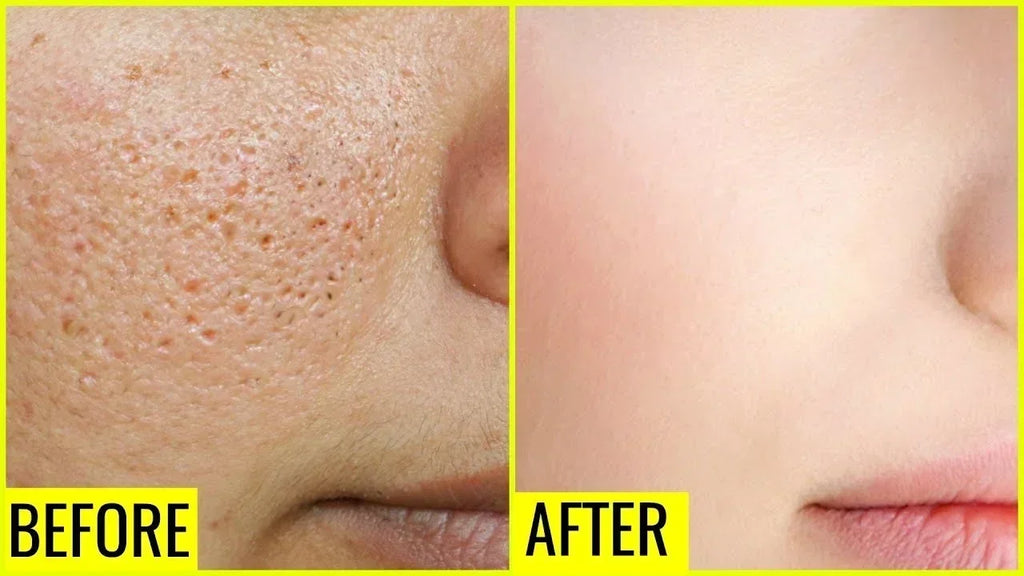 Pore Shrink Face Serum