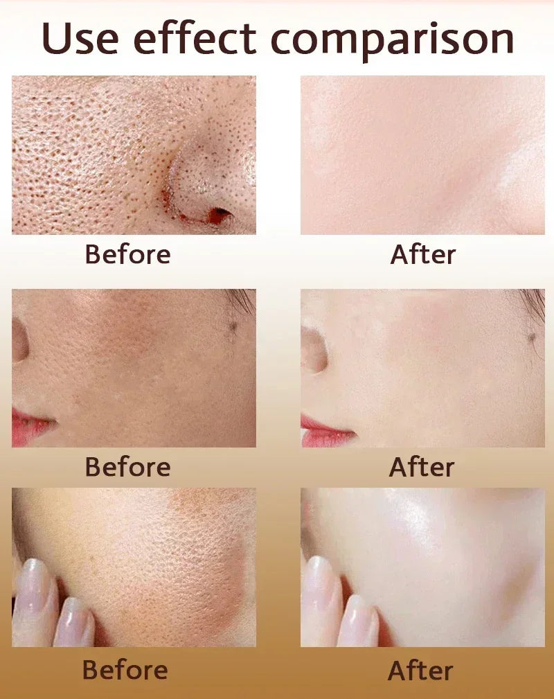 Pore Shrink Face Serum