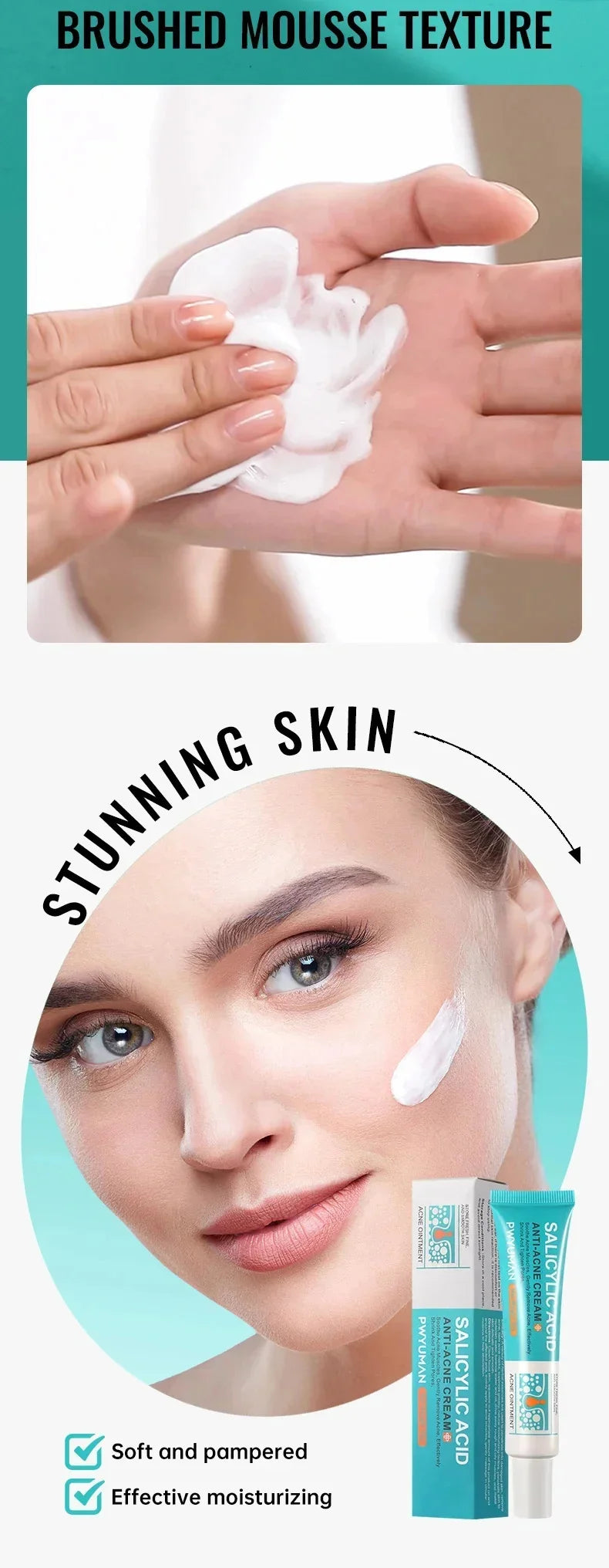 Salicylic Acid Acne Removal Cream
