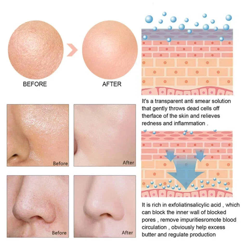 Pore Shrink Face Serum