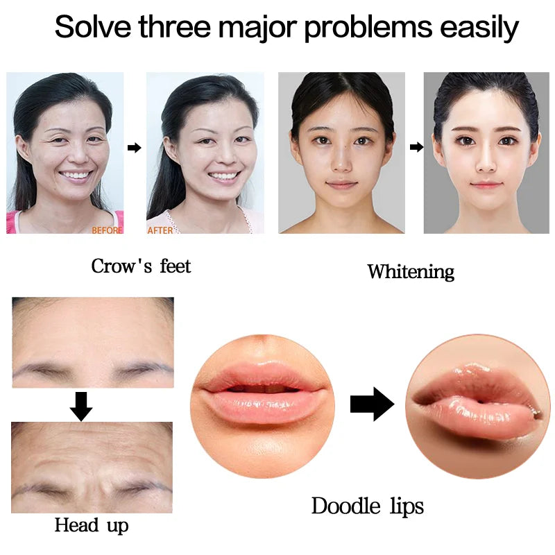 Hyaluron Pen 2in1 Meso Injection Hyaluronic Acid Atomize